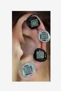 Keloid Pressure earrings, Earlums, Clipons, Keloid scars concealment, ouch-less earrings, handmade in USA, wire wrapped earrings, clipons, helix earrings,