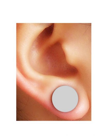 Ear Keloid Compression Plastic Discs Plastic Disc Earring for Post-op Keloid  Pressure 'bean' Shape 3 Sizes Available 